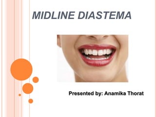 MIDLINE DIASTEMA
Presented by: Anamika Thorat
 