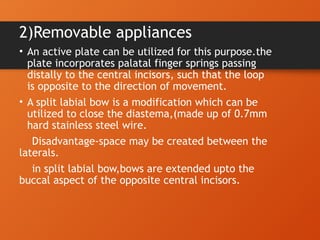 midlinediastema diagnosos treatment planning and clinical signs | PPTX