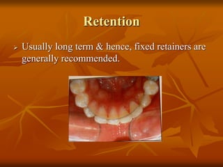 Retention
Usually long term & hence, fixed retainers are
generally recommended.