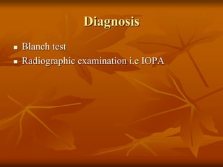 Diagnosis
Blanch test
Radiographic examination i.e IOPA