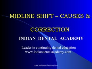 MIDLINE SHIFT – CAUSES &
CORRECTION
INDIAN DENTAL ACADEMY
Leader in continuing dental education
www.indiandentalacademy.com

www.indiandentalacademy.com

 