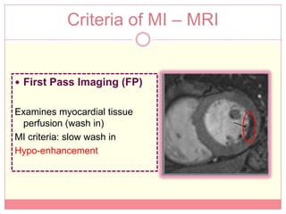 Criteria of MI – MRI


 First Pass Imaging (FP)


Examines myocardial tissue
 perfusion (wash in)
MI criteria: slow wash in
Hypo-enhancement
 