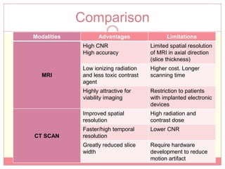 Comparison
Modalities          Advantages                Limitations
              High CNR                  Limited spatial resolution
              High accuracy             of MRI in axial direction
                                        (slice thickness)
              Low ionizing radiation    Higher cost. Longer
   MRI        and less toxic contrast   scanning time
              agent
              Highly attractive for     Restriction to patients
              viability imaging         with implanted electronic
                                        devices
              Improved spatial          High radiation and
              resolution                contrast dose
              Faster/high temporal      Lower CNR
CT SCAN       resolution
              Greatly reduced slice     Require hardware
              width                     development to reduce
                                        motion artifact
 