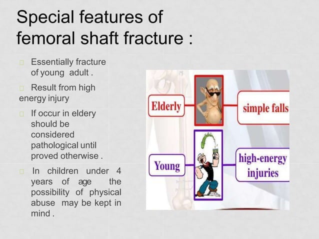 midshaft-femur-fracture-pptx