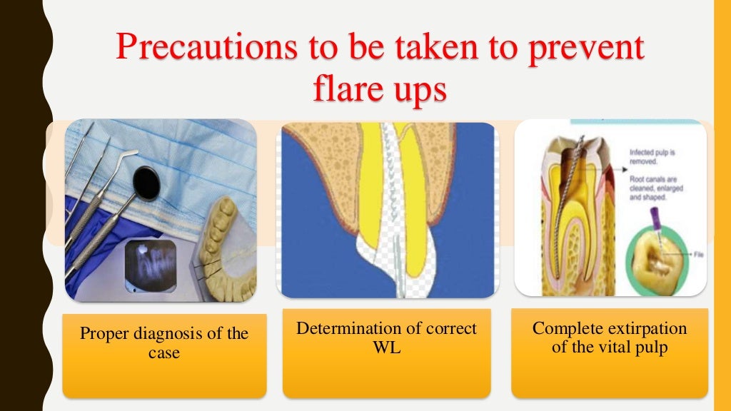 Mid treatment flare ups in endodontic