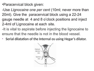 Paracervical Injection MID TRIMESTER TERMINATION OF PREGNANCY.key final.pptx