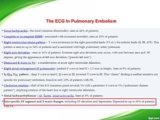 The ECG In Pulmonary Embolism
 
