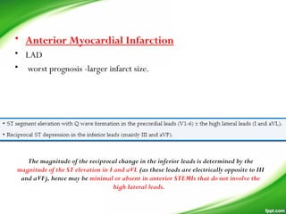 • Anterior Myocardial Infarction
• LAD
• worst prognosis -larger infarct size.
The magnitude of the reciprocal change in the inferior leads is determined by the
magnitude of the ST elevation in I and aVL (as these leads are electrically opposite to III
and aVF), hence may be minimal or absent in anterior STEMIs that do not involve the
high lateral leads. 
 