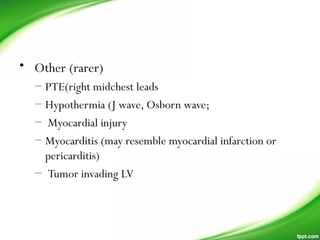 • Other (rarer)   
– PTE(right midchest leads
– Hypothermia (J wave, Osborn wave;
– Myocardial injury
– Myocarditis (may resemble myocardial infarction or
pericarditis)
– Tumor invading LV  
 