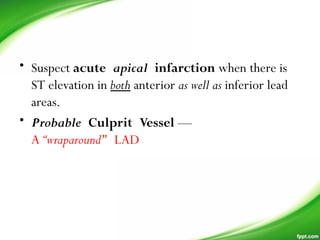 • Suspect acute apical infarction when there is
ST elevation in both anterior as well as inferior lead
areas.
• Probable Culprit Vessel —
A “wraparound" LAD
 