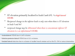 • ST elevation primarily localised to leads I and aVL =a high lateral
STEMI.
• Reciprocal change in the inferior leads is only seen when there is ST elevation
in leads I and Avl
• reciprocal change may be obliterated when there is concomitant inferior ST
elevation (i.e an inferolateral STEMI)
 