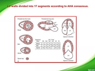 LV walls divided into 17 segments according to AHA consensus.
 