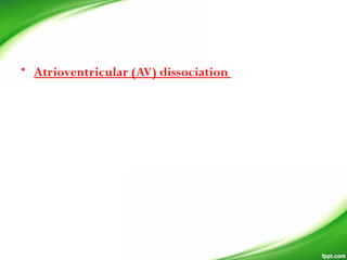 • Atrioventricular (AV) dissociation
 