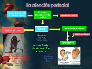 ANEMIA HIPERBILIRRUBINEMIA
HIDROPESIA FETAL
Fijación de IgG anti-D
a hematíes fetales
Secuestro y
destrucción rápida
por el bazo
Muerte fetal y
aborto en el 2do
trimestre
Disminución
masiva de
hematíes fetales
(anemia grave)
Insuficiencia Cardíaca Fetal
Inflamación Corporal Total
Colapso Circulatorio
KERNICTERUS
Convulsiones
Daño cerebral
Sordera
Muerte
Gran riesgo de muerte
intrauterina
ESPLENOMEGALIA
HEPATOMEGALIA
Eritropoyesis
Compensatoria
Depósitos de bilirrubina en cerebro
 