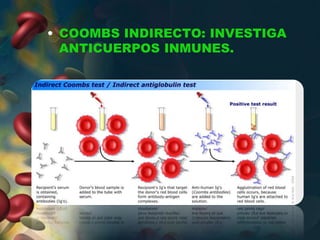 • COOMBS INDIRECTO: INVESTIGA
ANTICUERPOS INMUNES.
 