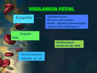 VIGILANCIA FETAL
Doppler
fetal
Mide la
ACM
• polihidramnios
•Derrame pericardico
•Ascitis , hepatoesplenomegala
• edema fetal (hidropesía)
Amniocentesis
estudia al LA
•Cordocentesis
niveles de Hg fetal
Ecografía
DX
 