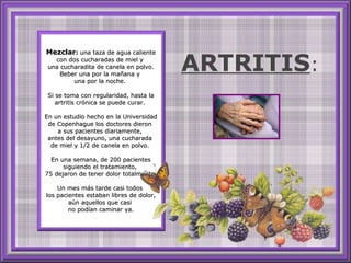 Mezclar :  una taza de agua caliente con dos cucharadas de miel y  una cucharadita de canela en polvo. Beber una por la mañana y  una por la noche.  Si se toma con regularidad, hasta la artritis crónica se puede curar.  En un estudio hecho en la Universidad de Copenhague los doctores dieron  a sus pacientes diariamente,  antes del desayuno, una cucharada  de miel y 1/2 de canela en polvo.  En una semana, de 200 pacientes siguiendo el tratamiento,  75 dejaron de tener dolor totalmente. Un mes más tarde casi todos  los pacientes estaban libres de dolor, aún aquellos que casi  no podían caminar ya. ARTRITIS : 