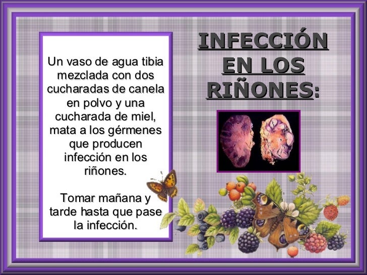 Los síntomas peligrosos al dolor en la espalda