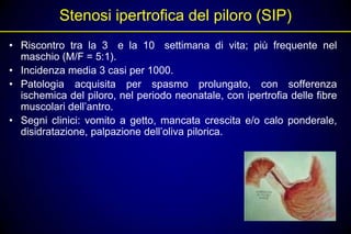 Stenosi ipertrofica del piloro (SIP)
• Riscontro tra la 3 e la 10 settimana di vita; più frequente nel
  maschio (M/F = 5:1).
• Incidenza media 3 casi per 1000.
• Patologia acquisita per spasmo prolungato, con sofferenza
  ischemica del piloro, nel periodo neonatale, con ipertrofia delle fibre
  muscolari dell’antro.
• Segni clinici: vomito a getto, mancata crescita e/o calo ponderale,
  disidratazione, palpazione dell’oliva pilorica.
 