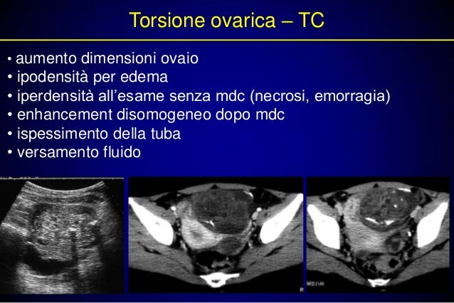 Corpo Luteo Emorragico Si Riassorbe