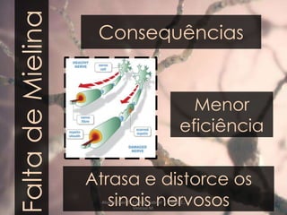 FaltadeMielina Consequências
Menor
eficiência
Atrasa e distorce os
sinais nervososAlunos: Davi T., Erick D. Gabriel T., Paulo Z.,
Vinícius M.