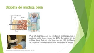 Biopsia de medula osea
Para el diagnóstico de un síndrome mielodisplásico el
paciente debe tener menos de 20% de blastos en su
médula ósea. Cuando ésta tiene más de 20% de blastos
se considera que el paciente tiene una leucemia aguda.
Myelodysplastic Syndrome Overview American cáncer society. Año 2014
 