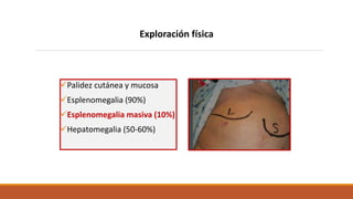 Exploración física
Palidez cutánea y mucosa
Esplenomegalia (90%)
Esplenomegalia masiva (10%)
Hepatomegalia (50-60%)
 