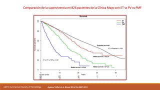 Comparación de la supervivencia en 826 pacientes de la Clínica Mayo con ET vs PV vs PMF
Ayalew Tefferi et al. Blood 2014;124:2507-2513©2014 by American Society of Hematology
 