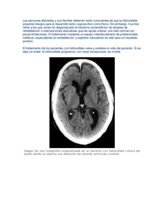 Las personas afectadas y sus familias deberían estar conscientes de que la hidrocefalia 
presenta riesgos para el desarrollo tanto cognoscitivo como físico. Sin embargo, muchos 
niños a los que se les ha diagnosticado el trastorno se benefician de terapias de 
rehabilitación e intervenciones educativas que les ayuda a llevar una vida normal con 
pocas limitaciones. El tratamiento mediante un equipo interdisciplinario de profesionales 
médicos, especialistas en rehabilitación y expertos educativos es vital para un resultado 
positivo. 
El tratamiento de los pacientes con hidrocefalia salva y sostiene la vida del paciente. Si se 
deja sin tratar, la hidrocefalia progresiva, con raras excepciones, es mortal. 
Imagen de una tomografía computarizada de un paciente con hidrocefalia crónica del 
adulto donde se observa una dilatación del sistema ventricular cerebral. 
 