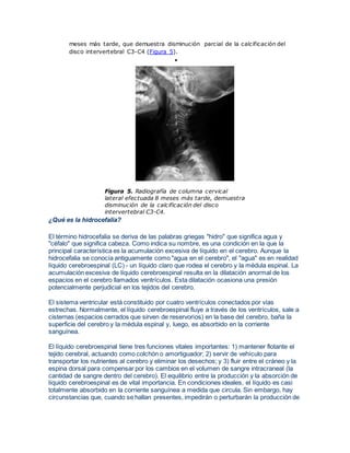 meses más tarde, que demuestra disminución parcial de la calcificación del 
disco intervertebral C3-C4 (Figura 5). 
 
Figura 5. Radiografía de columna cervical 
lateral efectuada 8 meses más tarde, demuestra 
disminución de la calcificación del disco 
intervertebral C3-C4. 
¿Qué es la hidrocefalia? 
El término hidrocefalia se deriva de las palabras griegas "hidro" que significa agua y 
"céfalo" que significa cabeza. Como indica su nombre, es una condición en la que la 
principal característica es la acumulación excesiva de líquido en el cerebro. Aunque la 
hidrocefalia se conocía antiguamente como "agua en el cerebro", el "agua" es en realidad 
líquido cerebroespinal (LC) - un líquido claro que rodea el cerebro y la médula espinal. La 
acumulación excesiva de líquido cerebroespinal resulta en la dilatación anormal de los 
espacios en el cerebro llamados ventrículos. Esta dilatación ocasiona una presión 
potencialmente perjudicial en los tejidos del cerebro. 
El sistema ventricular está constituido por cuatro ventrículos conectados por vías 
estrechas. Normalmente, el líquido cerebroespinal fluye a través de los ventrículos, sale a 
cisternas (espacios cerrados que sirven de reservorios) en la base del cerebro, baña la 
superficie del cerebro y la médula espinal y, luego, es absorbido en la corriente 
sanguínea. 
El líquido cerebroespinal tiene tres funciones vitales importantes: 1) mantener flotante el 
tejido cerebral, actuando como colchón o amortiguador; 2) servir de vehículo para 
transportar los nutrientes al cerebro y eliminar los desechos; y 3) fluir entre el cráneo y la 
espina dorsal para compensar por los cambios en el volumen de sangre intracraneal (la 
cantidad de sangre dentro del cerebro). El equilibrio entre la producción y la absorción de 
líquido cerebroespinal es de vital importancia. En condiciones ideales, el líquido es casi 
totalmente absorbido en la corriente sanguínea a medida que circula. Sin embargo, hay 
circunstancias que, cuando se hallan presentes, impedirán o perturbarán la producción de 
 