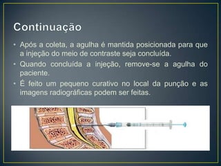 • Após a coleta, a agulha é mantida posicionada para que
a injeção do meio de contraste seja concluída.
• Quando concluída a injeção, remove-se a agulha do
paciente.
• É feito um pequeno curativo no local da punção e as
imagens radiográficas podem ser feitas.

 