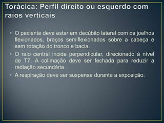 • O paciente deve estar em decúbito lateral com os joelhos
flexionados, braços semiflexionados sobre a cabeça e
sem rotação do tronco e bacia.
• O raio central incide perpendicular, direcionado à nível
de T7. A colimação deve ser fechada para reduzir a
radiação secundária.
• A respiração deve ser suspensa durante a exposição.

 