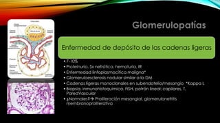 Enfermedad de depósito de las cadenas ligeras
•7-10%
•Proteinuria, Sx nefrótico, hematuria, IR
•Enfermedad linfoplasmocítica maligna*
•Glomeruloesclerosis nodular similar a la DM
•Cadenas ligeras monoclonales en subendotelio/mesangio *Kappa L
•Biopsia, inmunohistoquimica, FISH, patrón lineal: capilares, T,
ParedVascular
•¿Normales? Proliferación mesangial, glomerulonefritis
membranoproliferativa
 