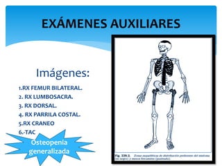 EXÁMENES AUXILIARES 
Imágenes: 
1.RX FEMUR BILATERAL. 
2. RX LUMBOSACRA. 
3. RX DORSAL. 
4. RX PARRILA COSTAL. 
5.RX CRANEO 
6.-TAC 
Osteopenia 
generalizada 
 