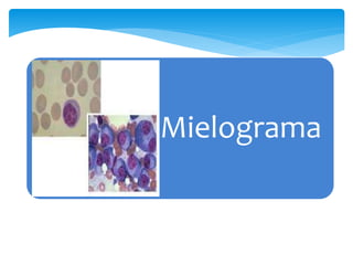 Mielograma 
 