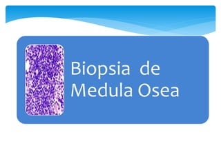 Biopsia de 
Medula Osea 
 