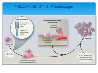 MIELOMA MÚLTIPLE - Fisiopatología 
 