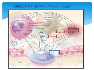MIELOMA MÚLTIPLE - Fisiopatología 
 