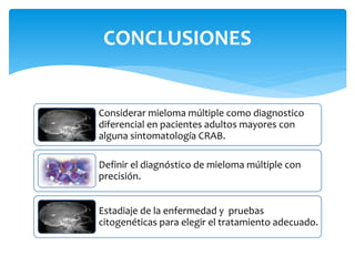 CONCLUSIONES 
Considerar mieloma múltiple como diagnostico 
diferencial en pacientes adultos mayores con 
alguna sintomatología CRAB. 
Definir el diagnóstico de mieloma múltiple con 
precisión. 
Estadiaje de la enfermedad y pruebas 
citogenéticas para elegir el tratamiento adecuado. 
 