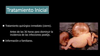 Tratamiento Inicial
 Tratamiento quirúrgico inmediato (cierre).
Antes de las 36 horas para disminuir la
incidencia de las infecciones postQx.
 Información a familiares.
 