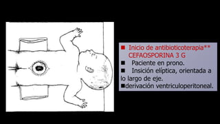  Inicio de antibioticoterapia**
CEFAOSPORINA 3 G
 Paciente en prono.
 Insición elíptica, orientada a
lo largo de eje.
derivación ventriculoperitoneal.
 