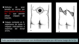  Defectos de gran
tamaño se cierran por
una insición en forma
de S, que permite
utilizar colgajos de
rotación.
 Colgajo romboide en Z,
expansores de tejido o
colgajos miócutáneos a
expensas del dorsal
ancho.
Todo paciente debe continuar con Antibioticoterapia por 48 horas luego de la Qx.
 