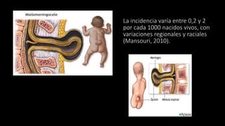 La incidencia varía entre 0,2 y 2
por cada 1000 nacidos vivos, con
variaciones regionales y raciales
(Mansouri, 2010).
Se define como un defecto sacular, roto o
íntegro, a nivel dorsal sobre la línea media,
75% de los casos lo hace en la región
lumbosacra.
 
