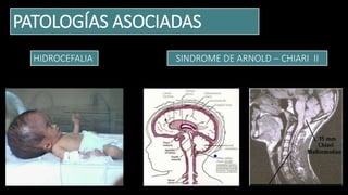 PATOLOGÍAS ASOCIADAS
HIDROCEFALIA SINDROME DE ARNOLD – CHIARI II
 
