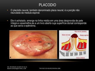PLACODIO
• O placódio neural, também denominado placa neural, é a porção não
neurulada da medula espinal.
• Ele é achatado, emerge na linha média em uma área desprovida de pele
íntegra e assemelha-se a um livro aberto cuja superfície dorsal corresponde
ao que seria o epêndima.
DR. PETERSON XAVIER DA SILVA
MEDPETERSON@HOTMAIL.COM TRATADO DE NEUROCIRURGIA SBN
 