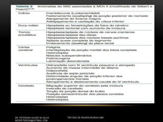 TRATADO DE NEUROCIRURGIA SBNDR. PETERSON XAVIER DA SILVA
MEDPETERSON@HOTMAIL.COM
 