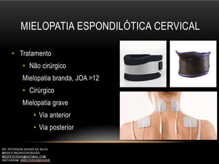 MIELOPATIA ESPONDILÓTICA CERVICAL
• Tratamento
• Não cirúrgico
Mielopatia branda, JOA >12
• Cirúrgico
Mielopatia grave
• Via anterior
• Via posterior
 