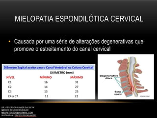 MIELOPATIA ESPONDILÓTICA CERVICAL
• Causada por uma série de alterações degenerativas que
promove o estreitamento do canal cervical
 