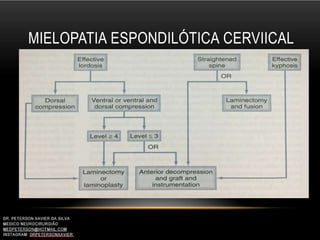MIELOPATIA ESPONDILÓTICA CERVIICAL
 