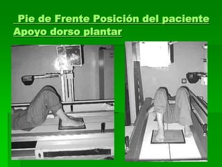 Pie de Frente Posición del paciente
Apoyo dorso plantar
 